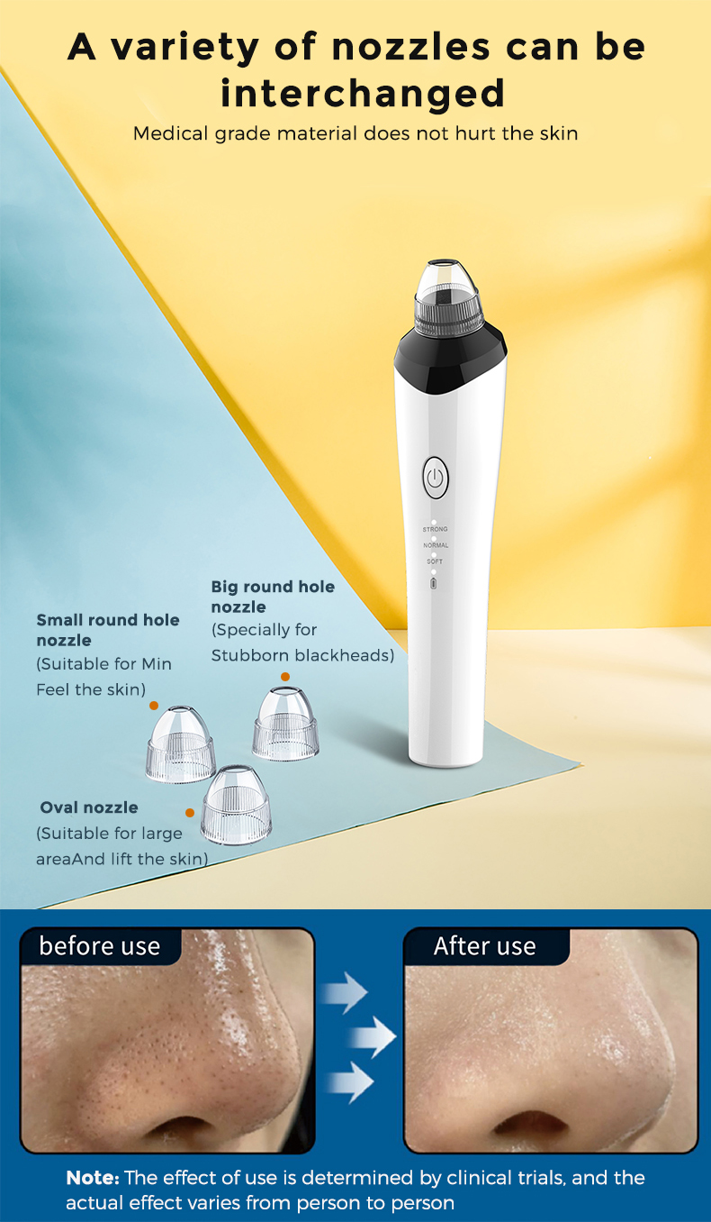 Visual blackhead meter (4)